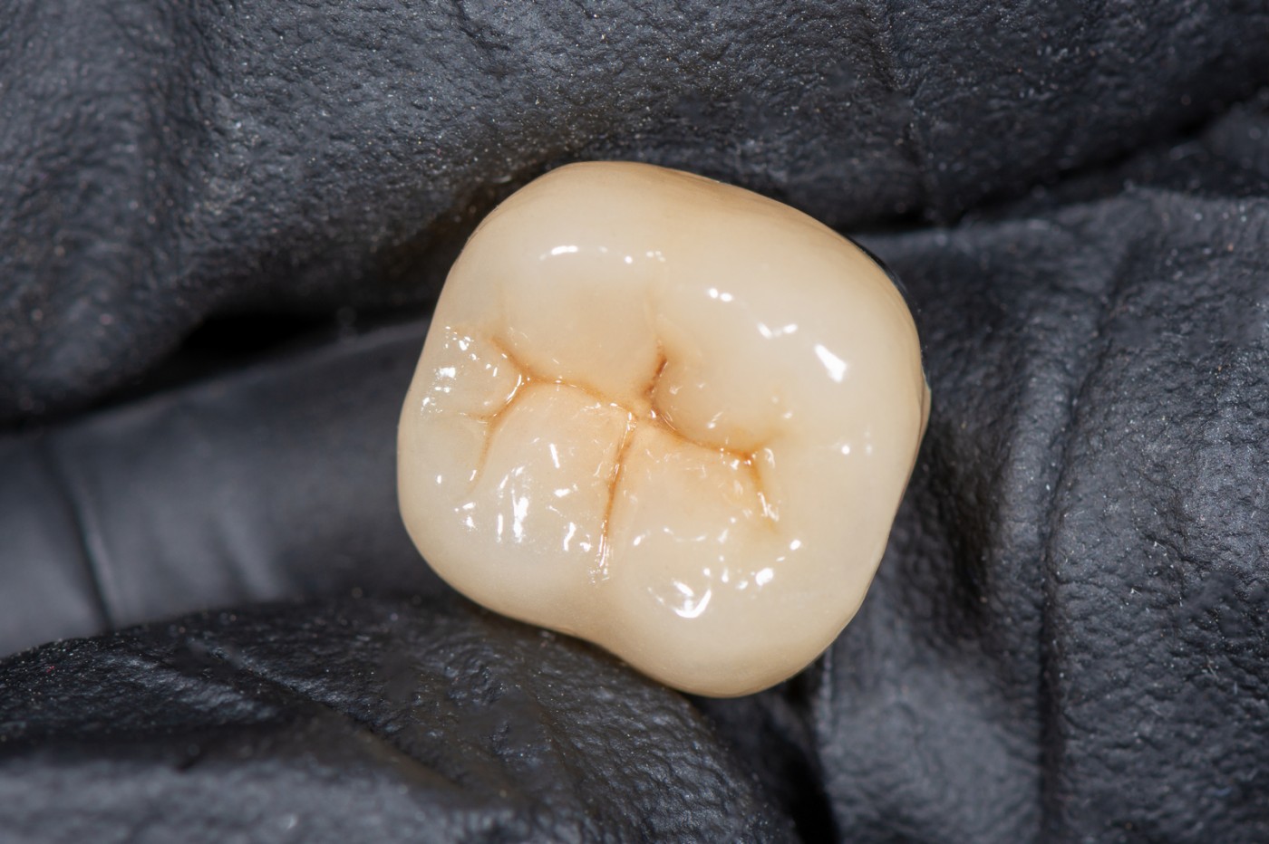 Coroane ceramică suport zirconiu București