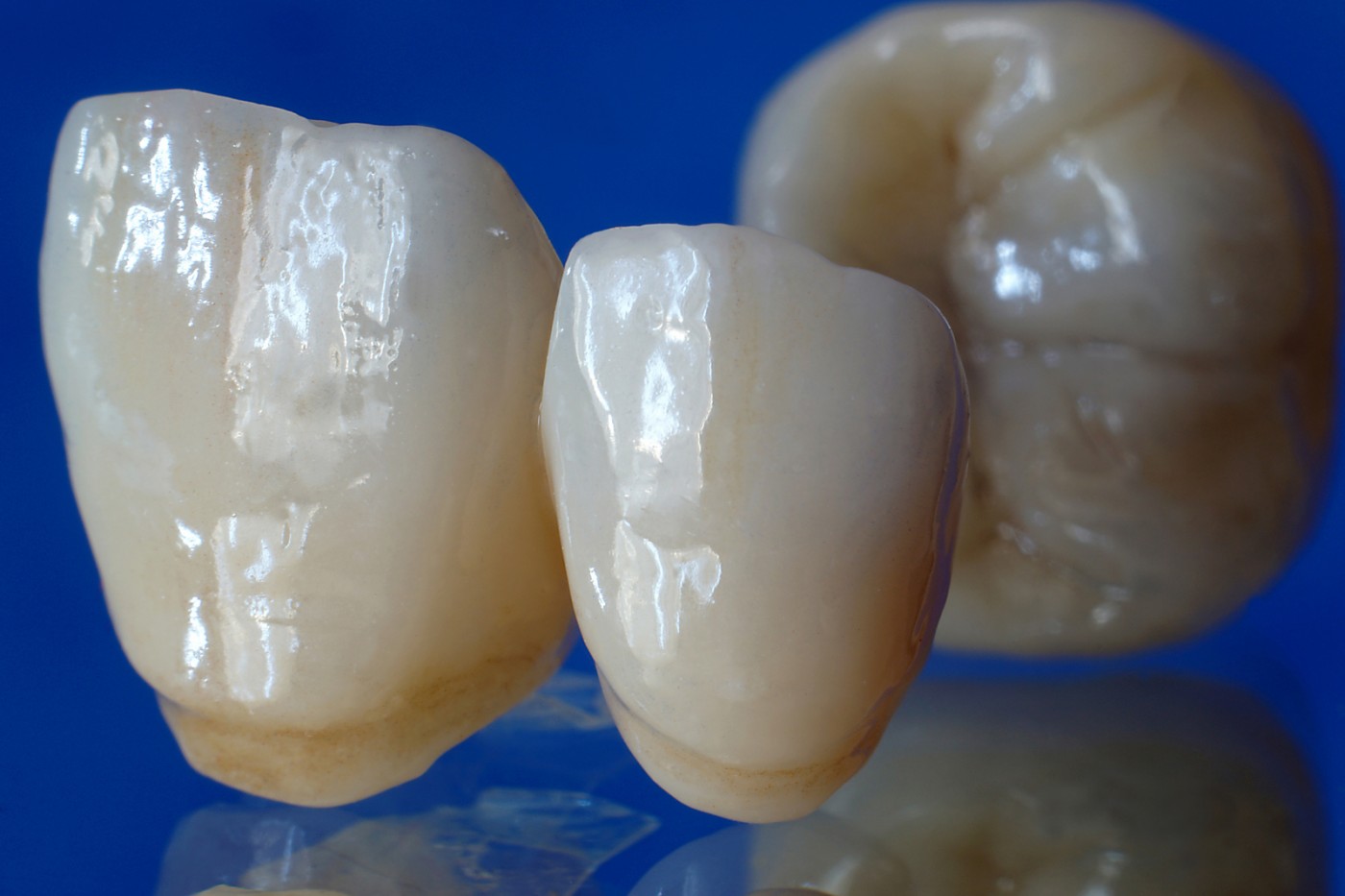 Coroane ceramice suport zirconiu București