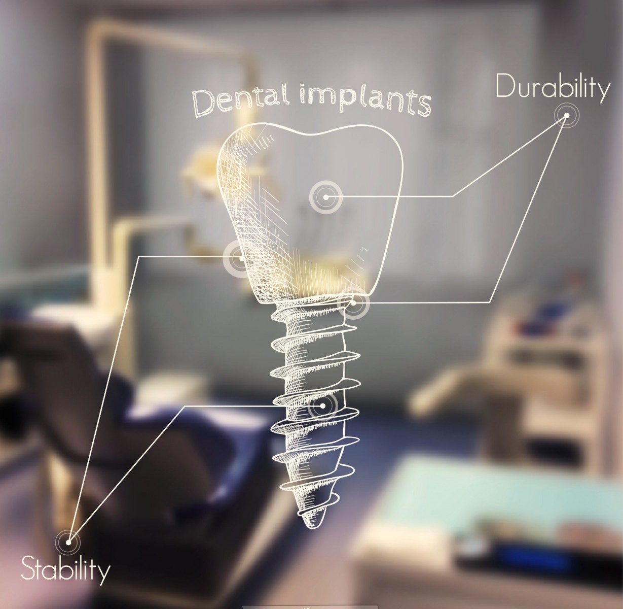 Implant dentar avansat clinica Lyrdent
