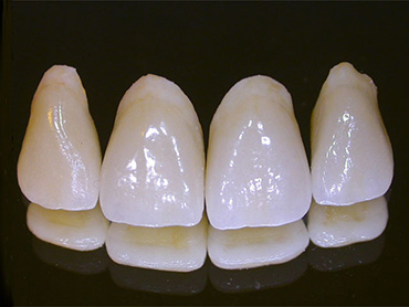 coroana zirconiu